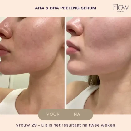 AHA & BHA results