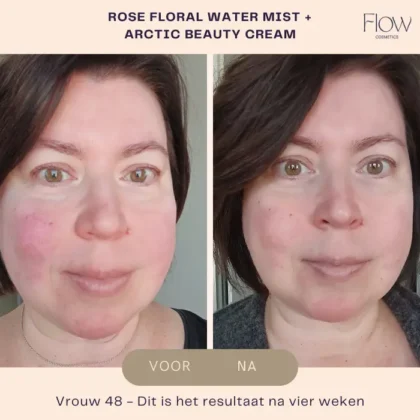 Arctic Beauty resultaat